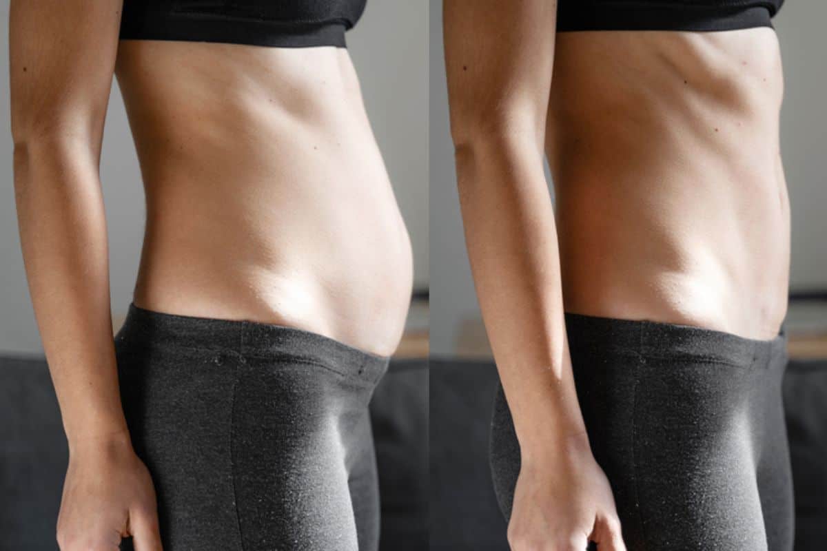Post-Pregnancy: What Happens to Your Abdominal Muscles After Birth Stoke-on-Trent