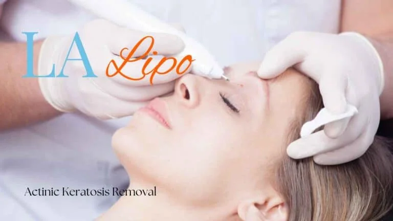 Woman receiving Actinic Keratosis Removal Treatment Stoke-on-Trent
