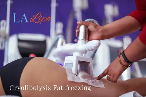 women getting fat freezing Stoke-on-Trent