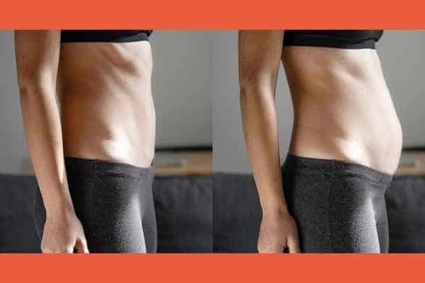 LA-EMS Body Sculpting results Stoke-on-Trent