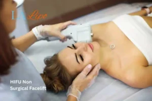 Woman having Hi-Fu to reduce wrinkles Stoke-on-Trent.