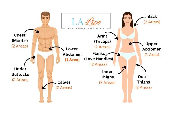 LA LIPO Cryolipolysis Areas Stoke-on-Trent