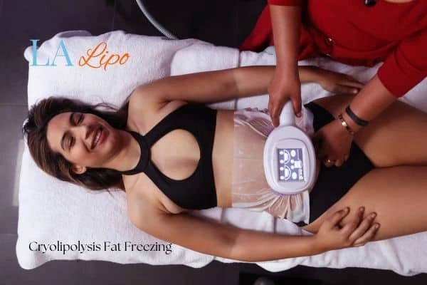 woman getting cryolipolysis Stoke-on-Trent