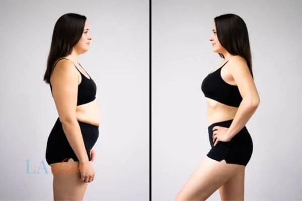 link between body image and mental health Stoke-on-Trent