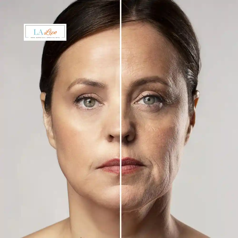 How Can You Tell If Non-Surgical Skin Tightening Is Right for You Stoke-on-Trent?