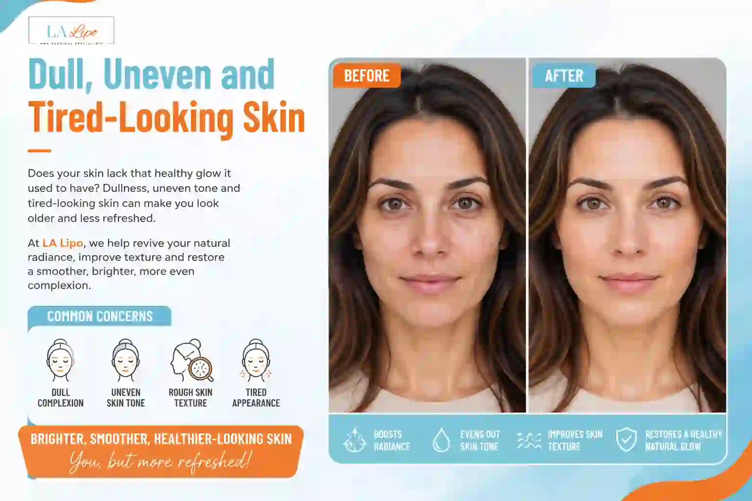 Sign #5: Dull, Uneven and Tired-Looking Skin Stoke-on-Trent