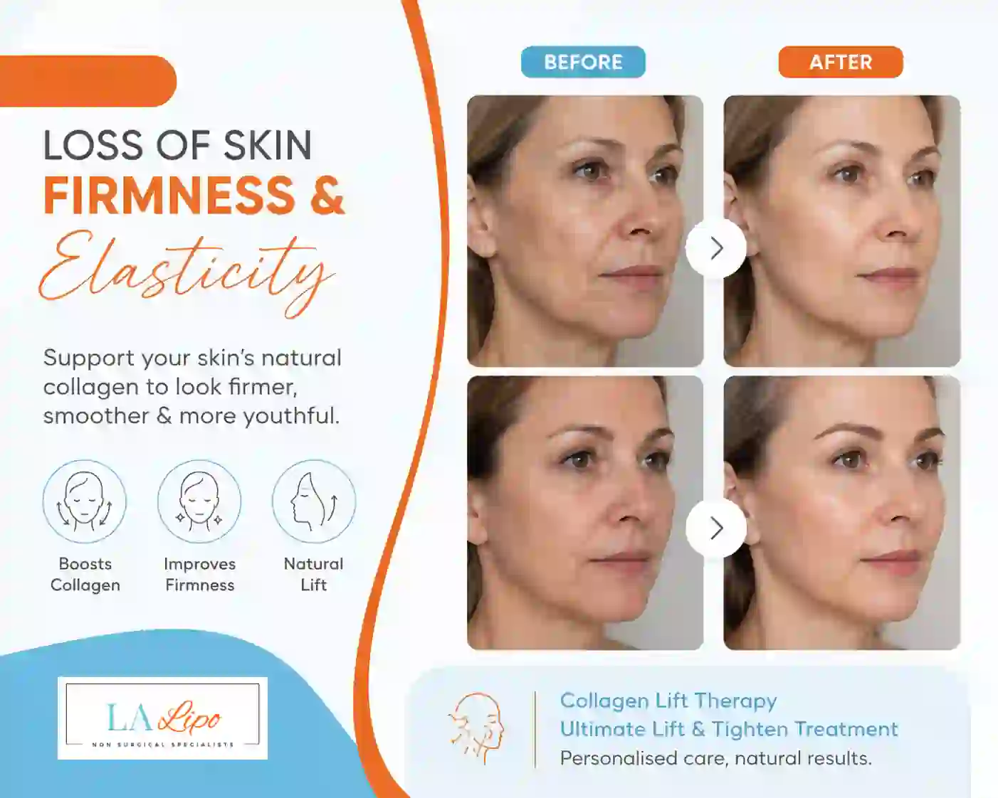 Sign #7: Loss of Skin Firmness and Elasticity Stoke-on-Trent